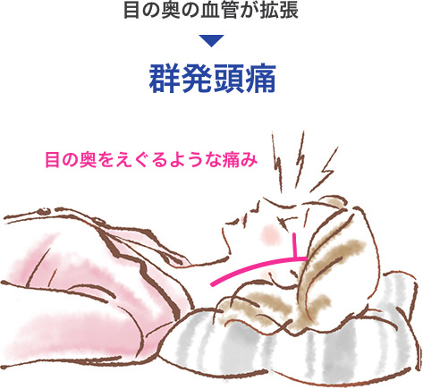 群発
