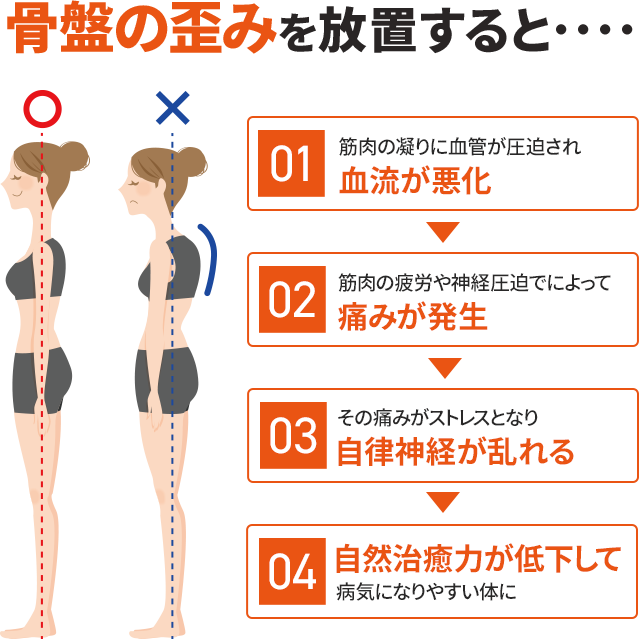 骨盤の歪みを放置すると・・・